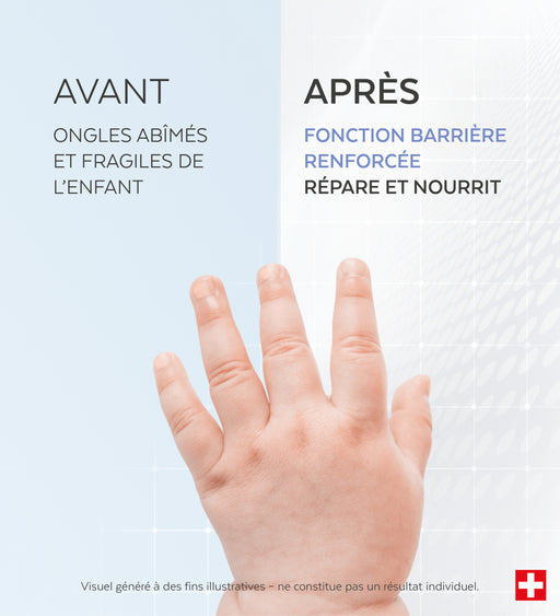 Sérum Ongles abîmés Enfant