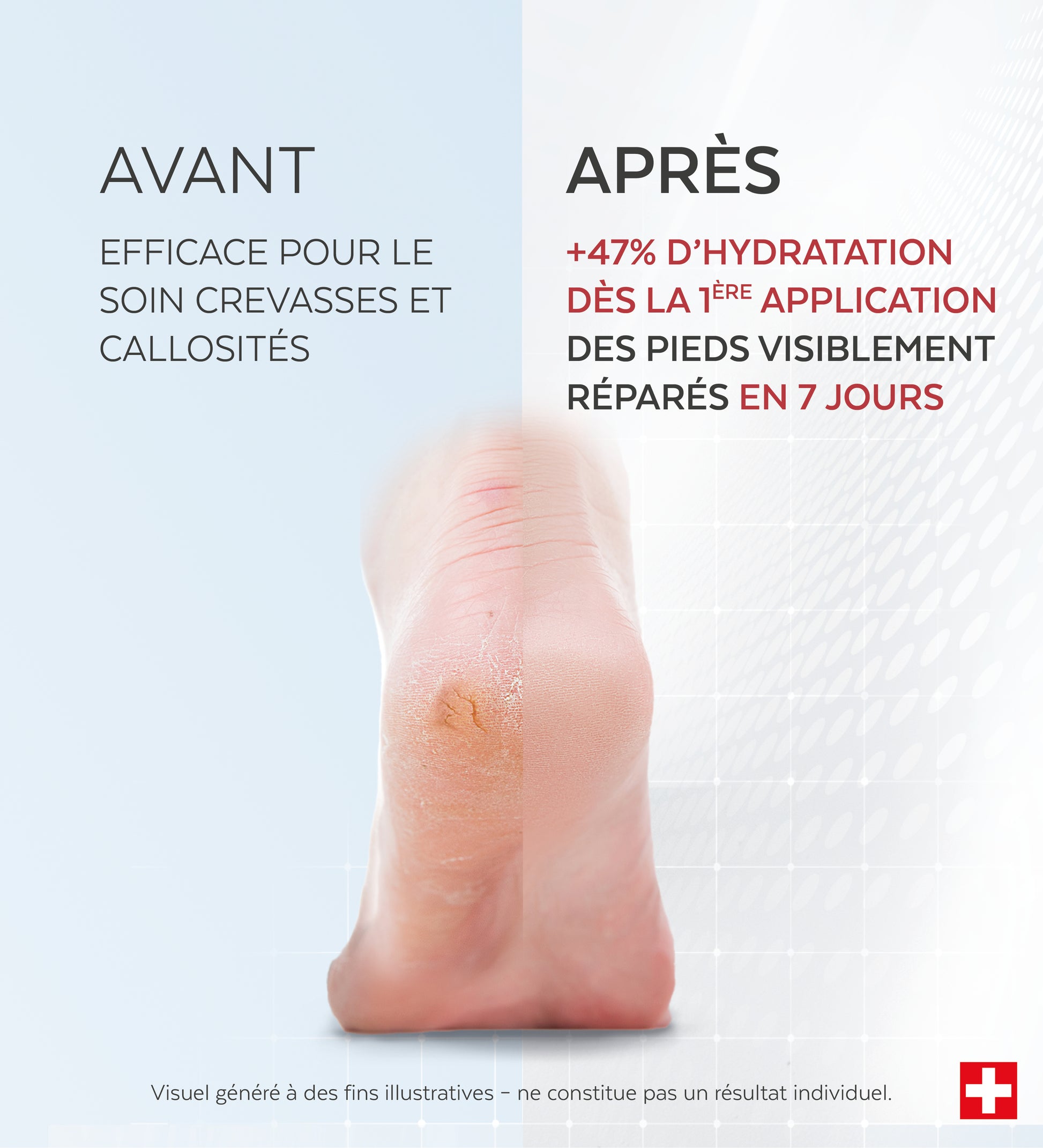 Soin Crevasses et Callosités
