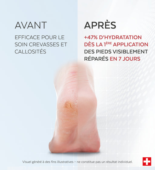 Soin Crevasses et Callosités