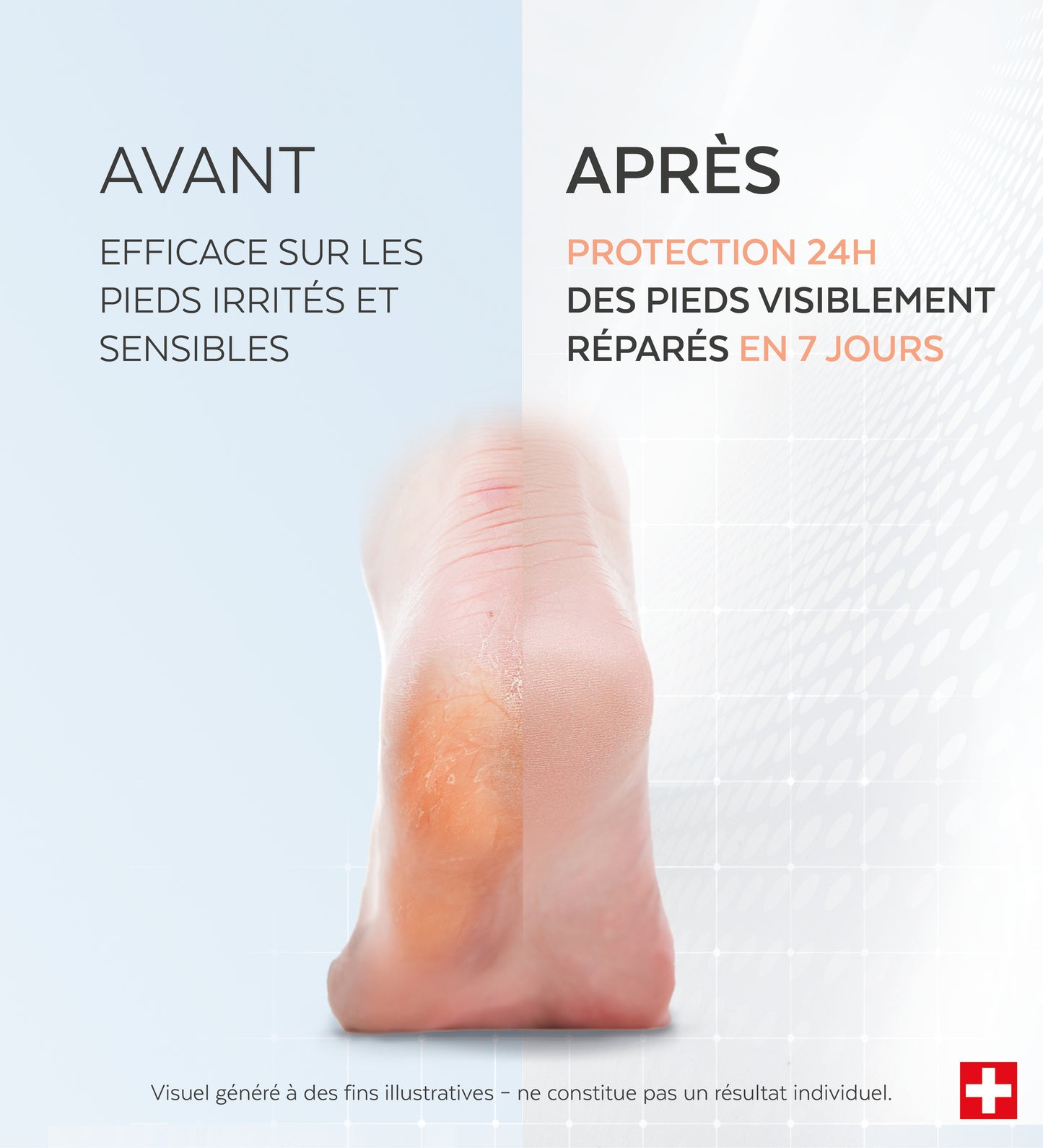 Sérum Pieds irrités et secs