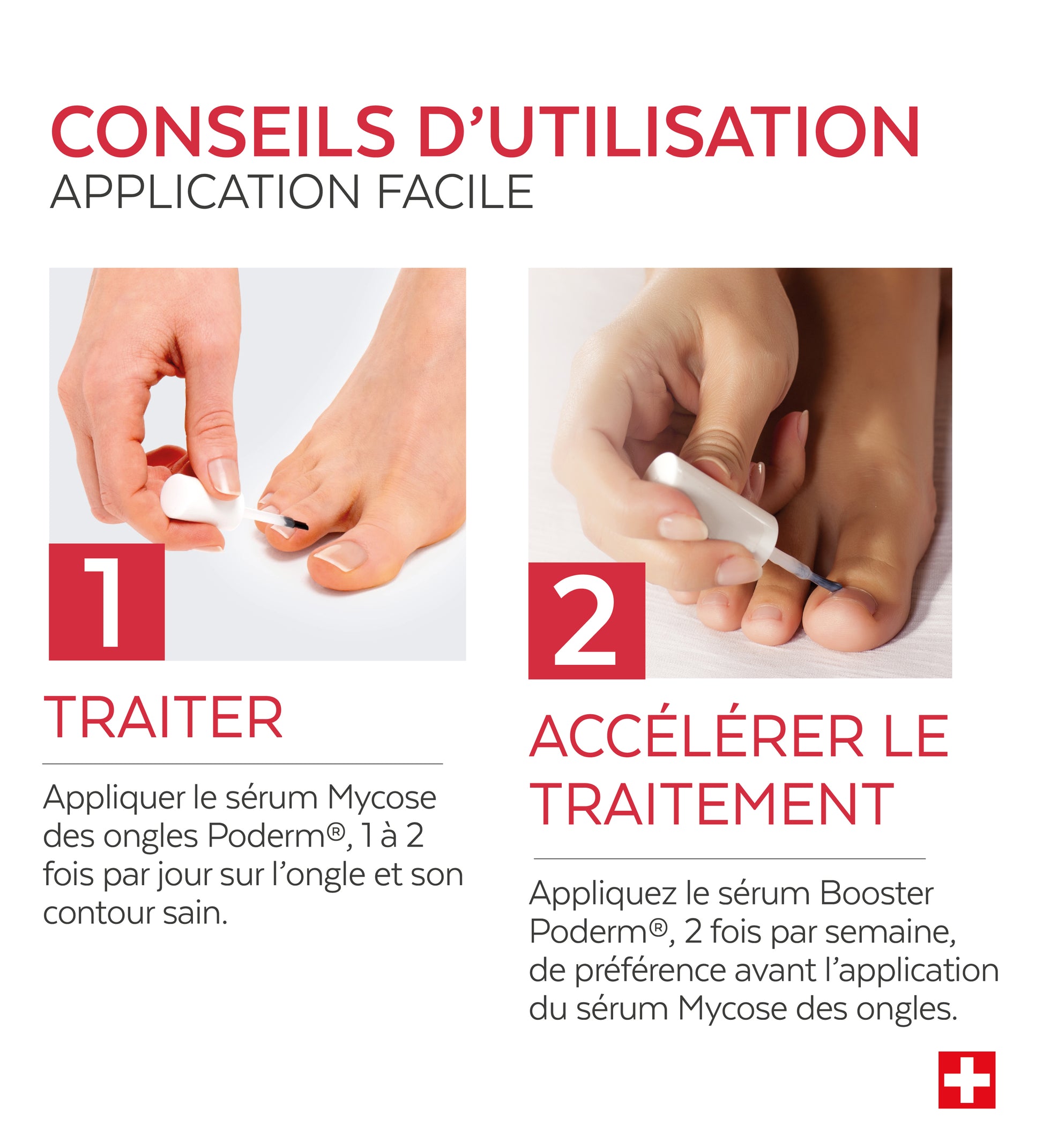 Sérum Booster - Mycose des ongles