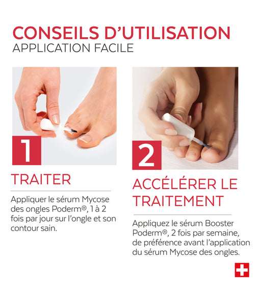 Sérum Booster - Mycose des ongles