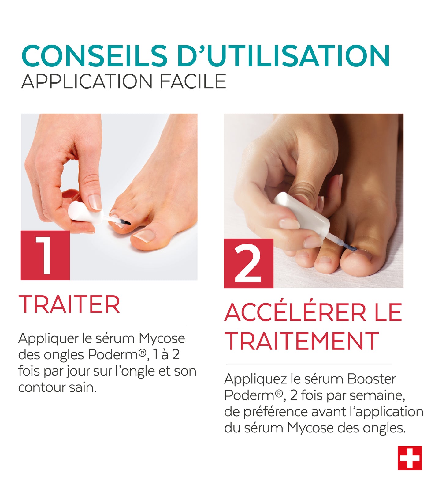 Duo express - Mycose des ongles