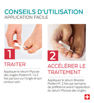 Duo express - Mycose des ongles