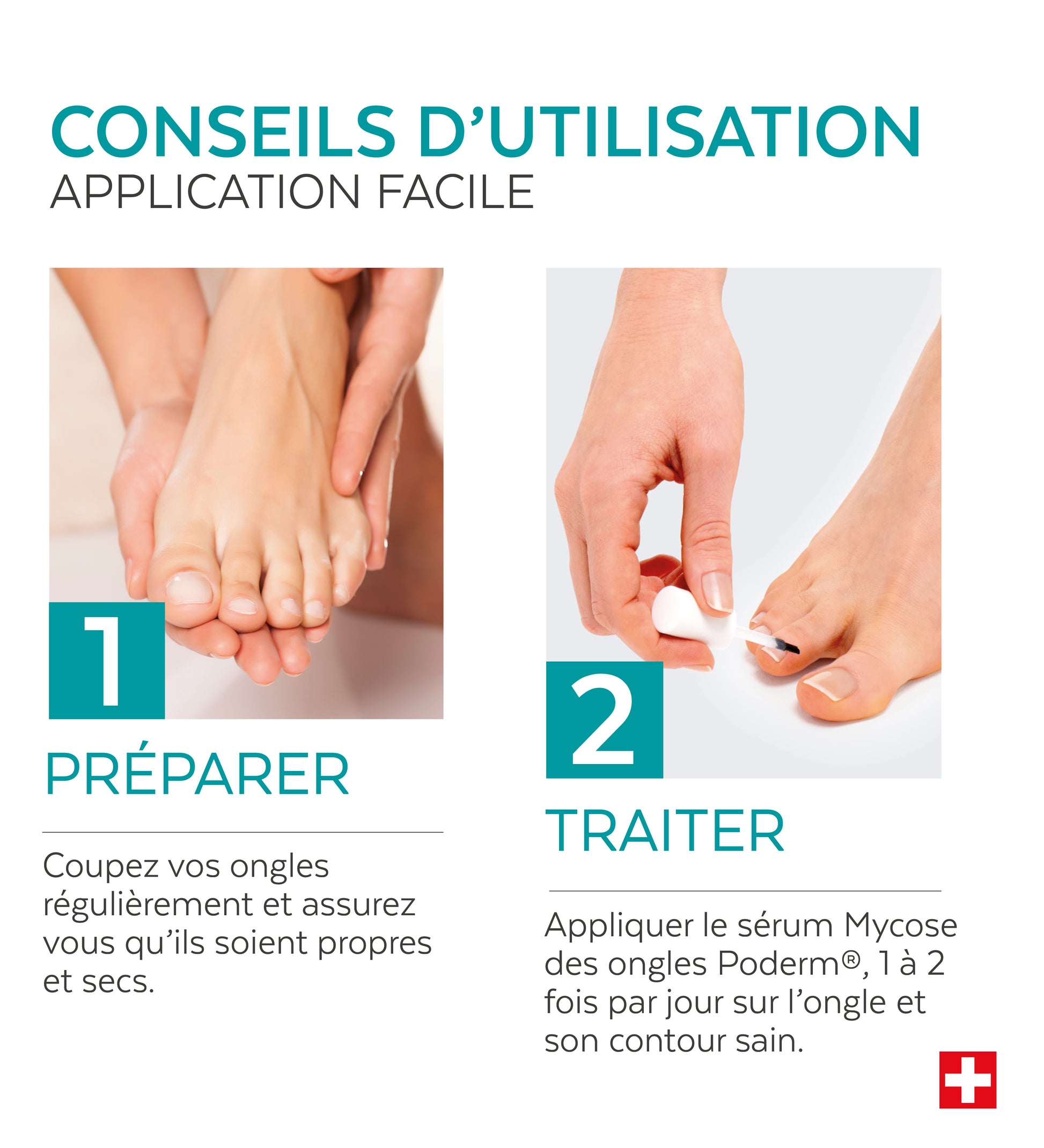 Sérum Mycose des ongles