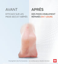 Sérum Pieds Très Secs et Abîmés