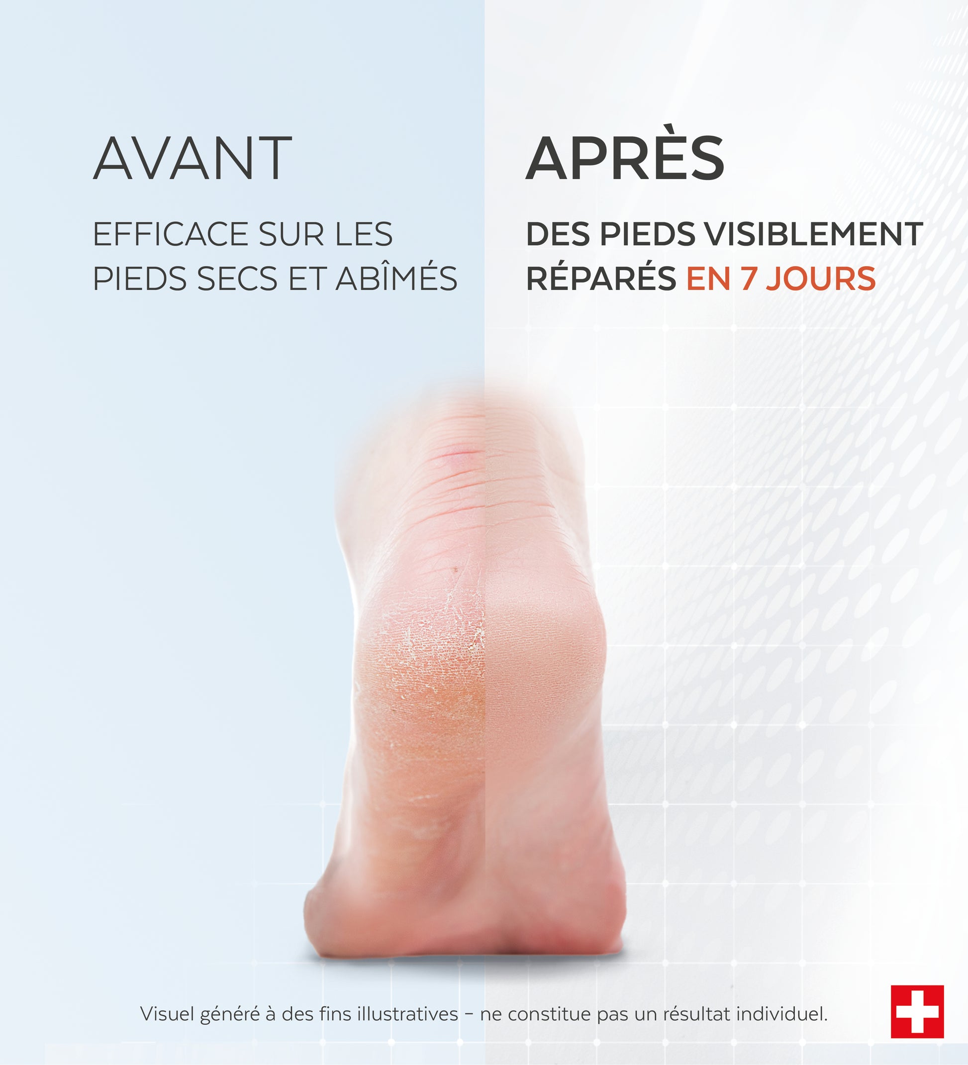 Sérum Pieds Très Secs et Abîmés