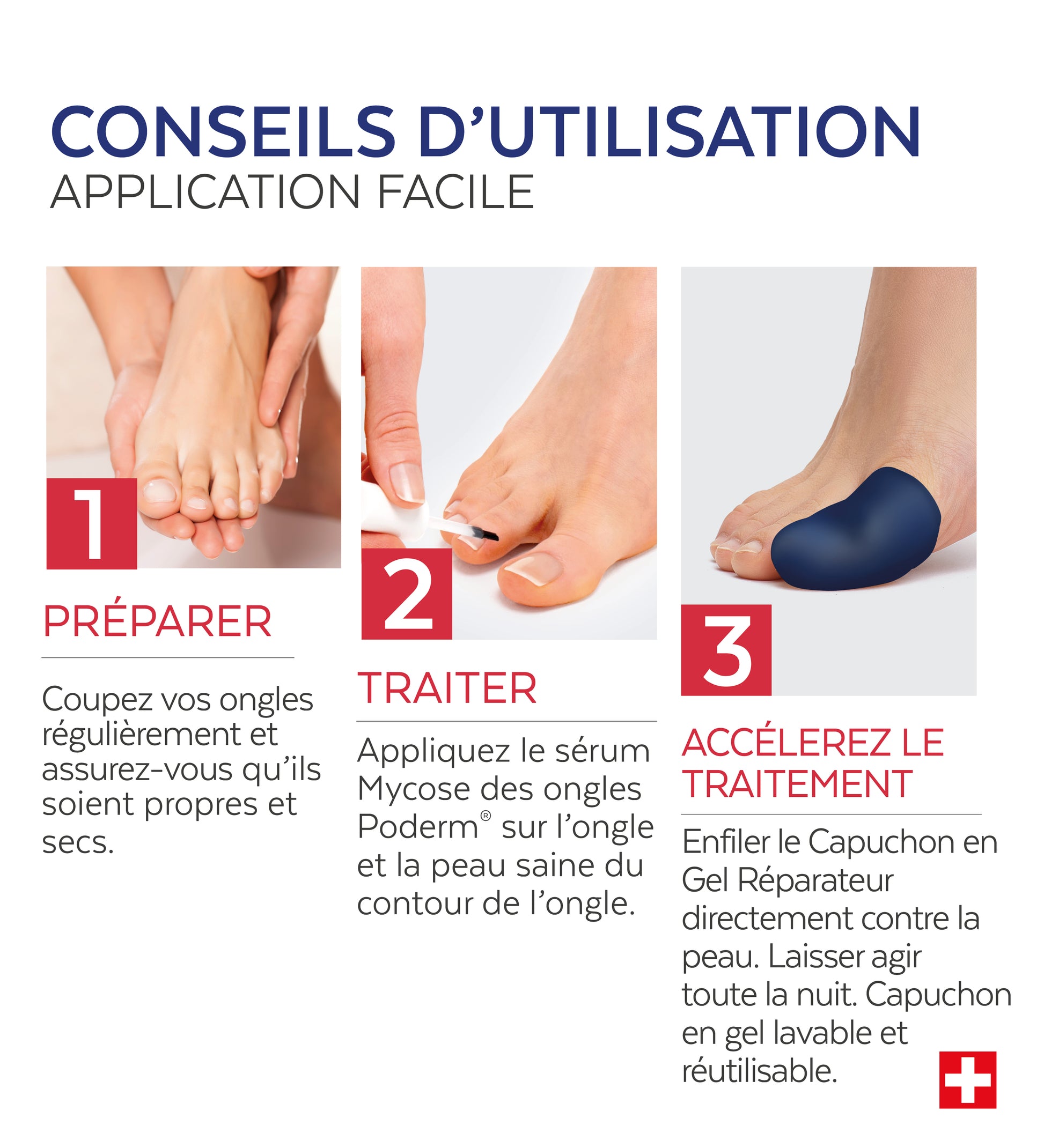 Traitement Intensif Nuit - Mycose des ongles